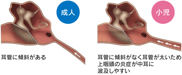 耳 みみ の病気 診療案内 じんのうち耳鼻咽喉科 福岡県那珂川市 旧 筑紫郡那珂川町