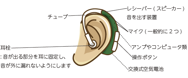 耳かけ型（BTEタイプ）