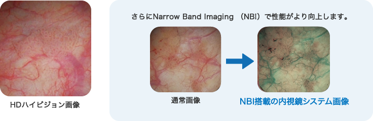 HDハイビジョン画像 / NBI搭載の内視鏡システム画像