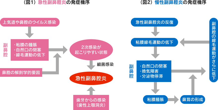 鼻腔 症状 副 炎