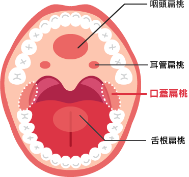 喉 のど の病気 診療案内 じんのうち耳鼻咽喉科 福岡県那珂川市 旧 筑紫郡那珂川町